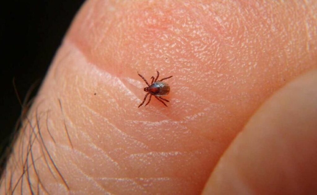 🚨 Alerta en Baja California: rickettsia alcanza letalidad cercana al 50% en&nbsp;2026